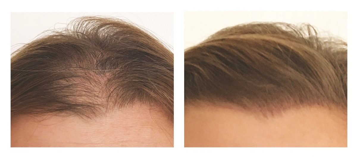 INVISIBLE KERATIN BOND Barclaywolf Hair Extensions